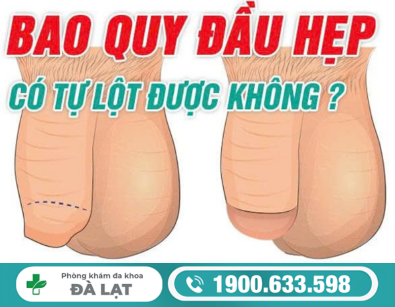 Hình ảnh minh họa